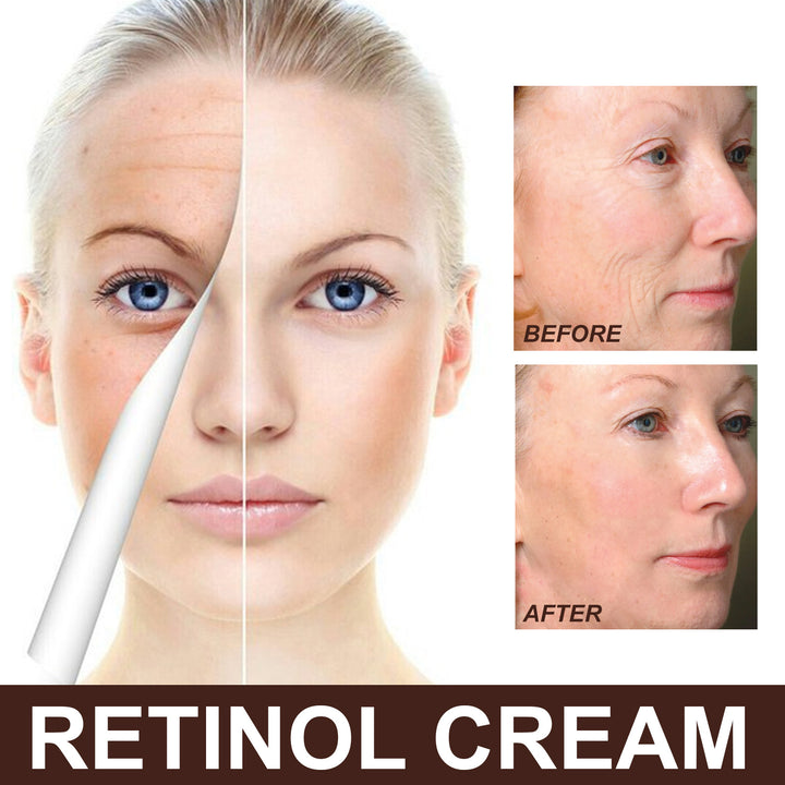 EELHOE Retinol Anti-Aging Cream - Shoperky